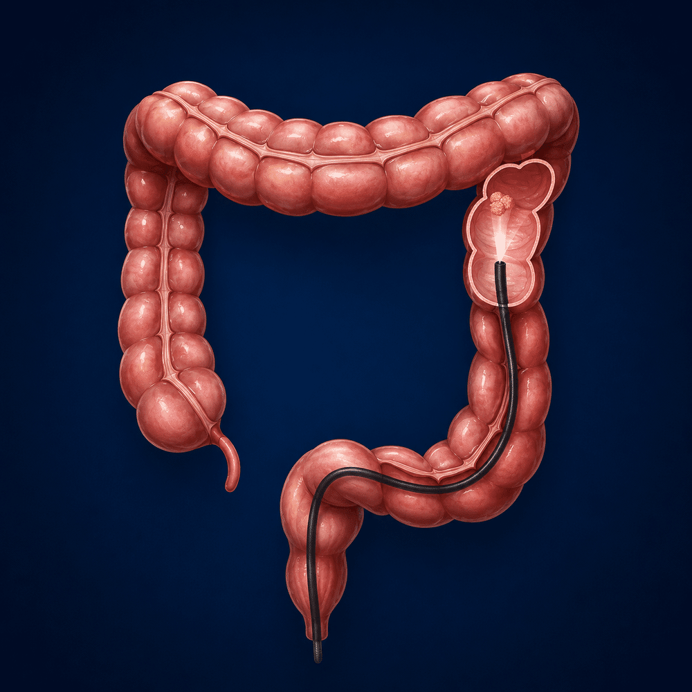 ADVANCED COLONOSCOPY